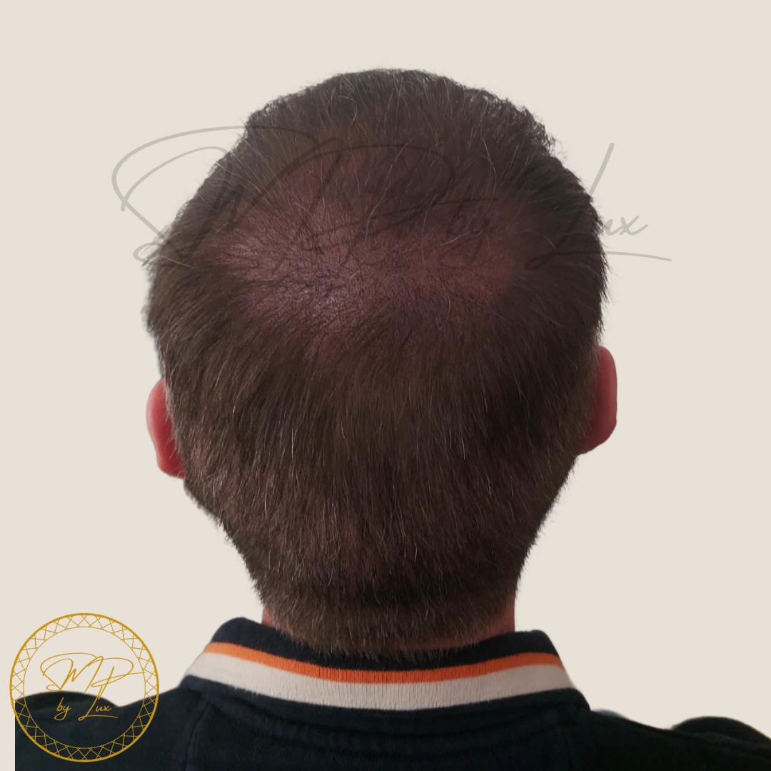 After SMP By Lux density restoration on an ivory background