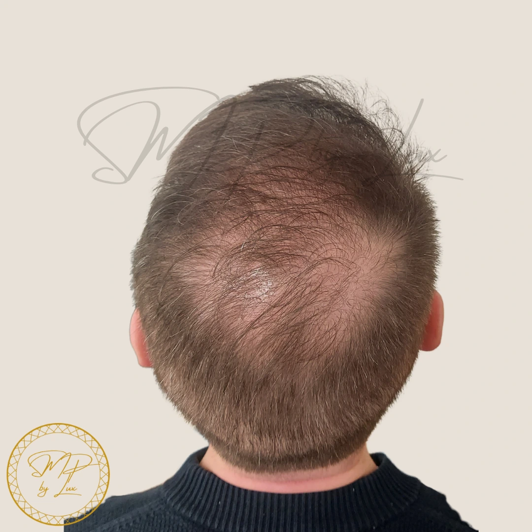 Before SMP By Lux density restoration on an ivory background