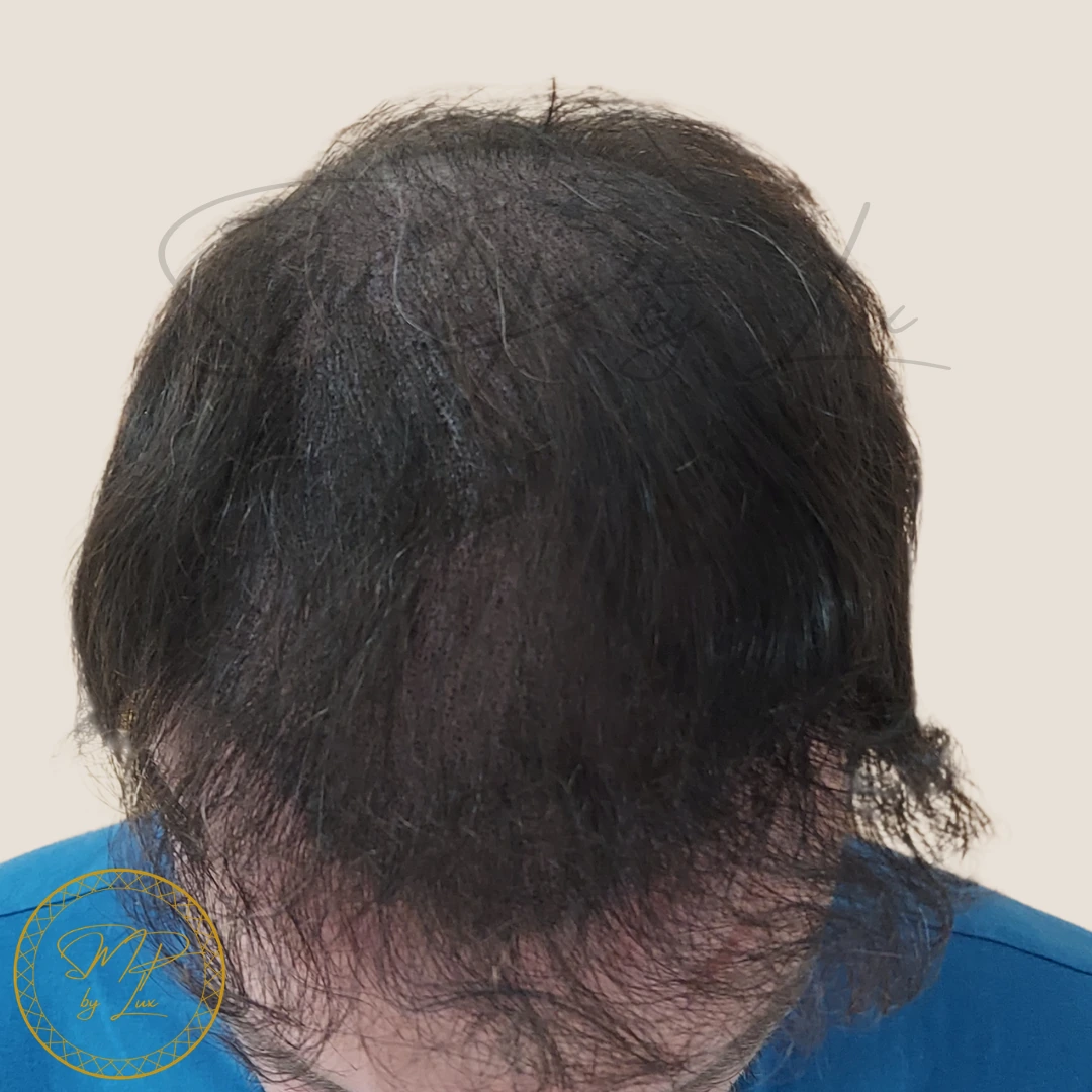 After SMP By Lux density treatment on an ivory background
