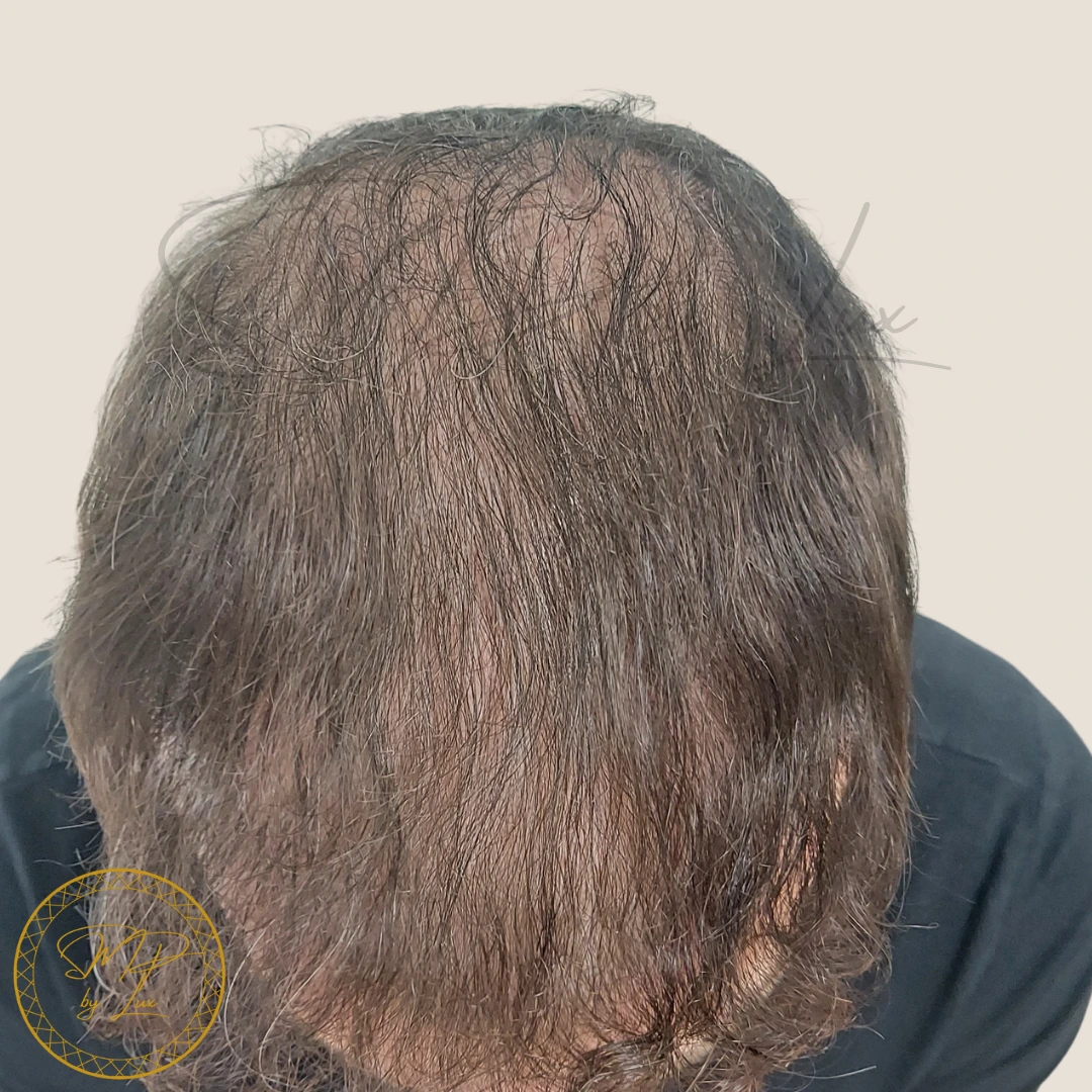 Before SMP By Lux density treatment on an ivory background