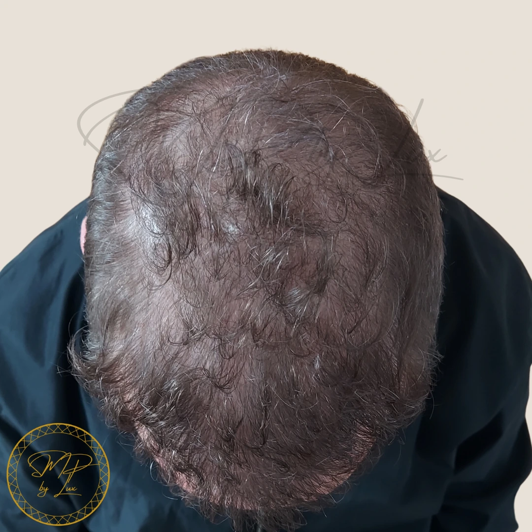 Before SMP By Lux density restoration on an ivory background